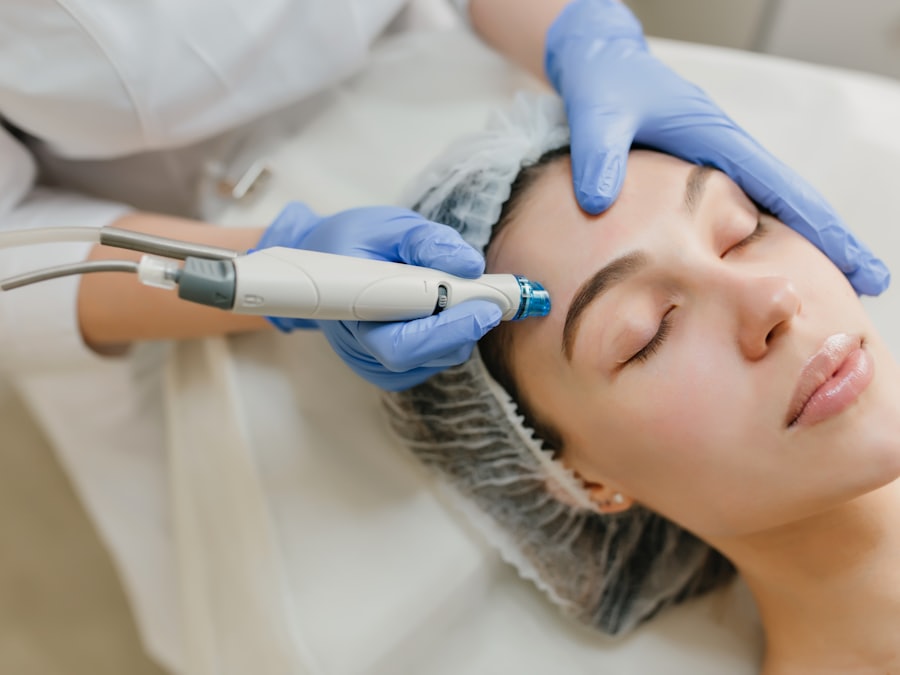 Laser skin resurfacing treatment