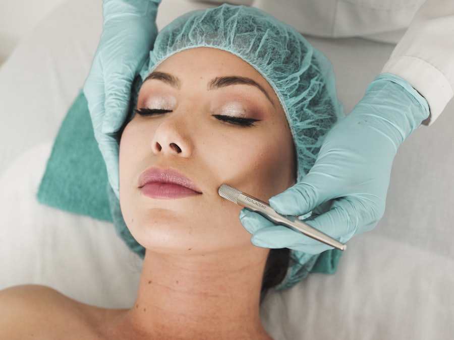 Microneedling skin treatment